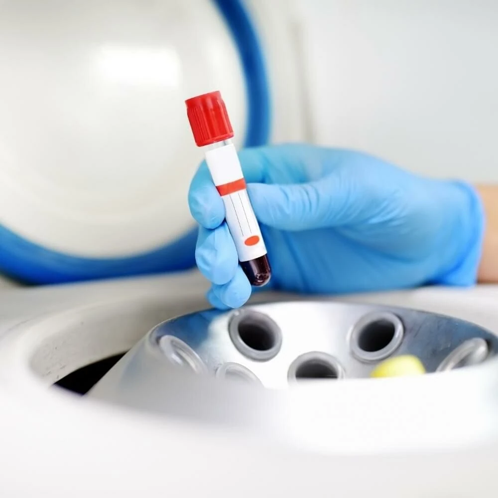 elektromag-santrifuj-cihazi-4-tup-m415m-6